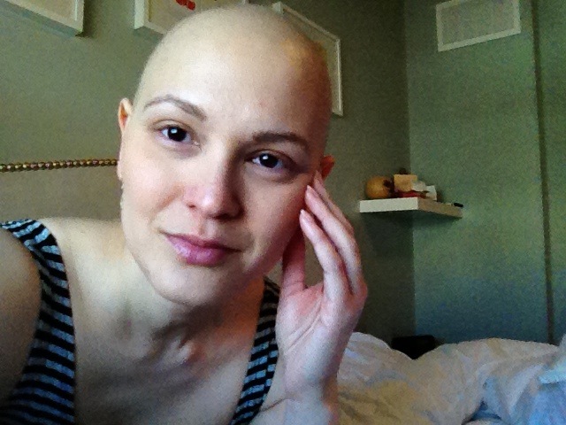 Me, post-chemo.
